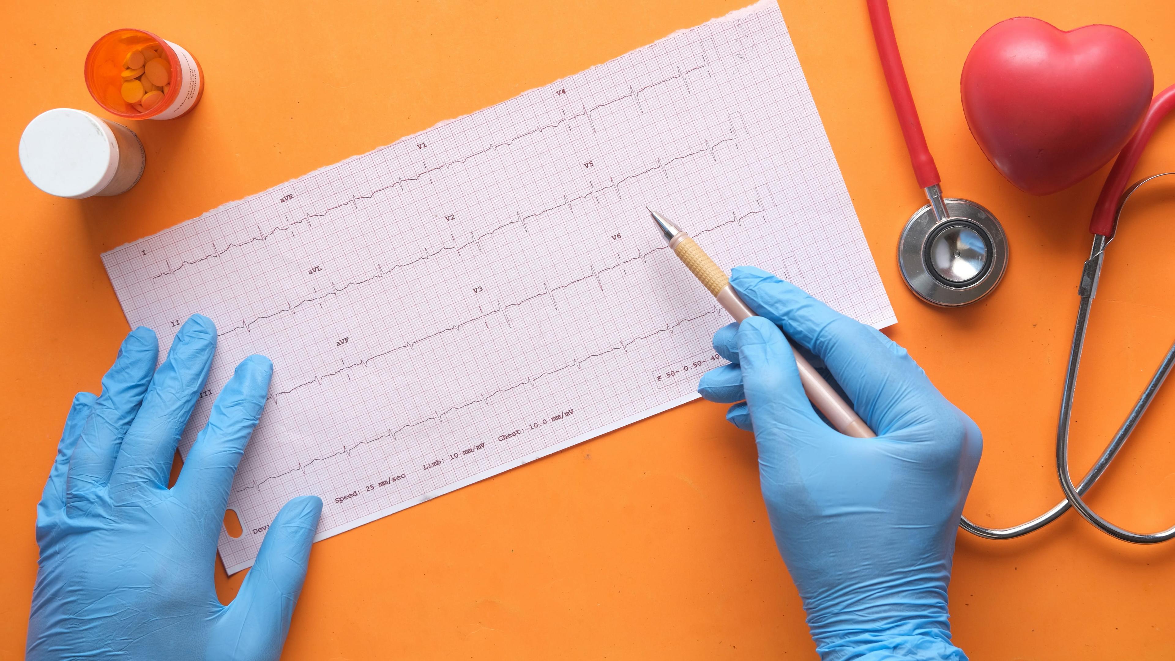 Zone 2 Heart Rate